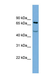 GOK / STIM1 Antibody - STIM1 antibody Western blot of PANC1 cell lysate. This image was taken for the unconjugated form of this product. Other forms have not been tested.