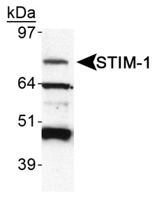 GOK / STIM1 Antibody - Detection of STIM-1 in HeLa WCE.  This image was taken for the unconjugated form of this product. Other forms have not been tested.
