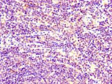 GOK / STIM1 Antibody - Immunohistochemistry of paraffin-embedded human lymph node tissue at dilution of 1:100