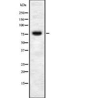 GOK / STIM1 Antibody - Western blot analysis STIM1 using HT29 whole cells lysates