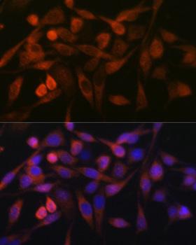 GOK / STIM1 Antibody - Immunofluorescence analysis of HeLa cells using STIM1 Polyclonal Antibody at dilution of 1:100.Blue: DAPI for nuclear staining.