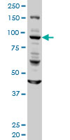 GOLGA1 / Golgin-97 Antibody - GOLGA1 monoclonal antibody (M01), clone 6G3 Western Blot analysis of GOLGA1 expression in HeLa.