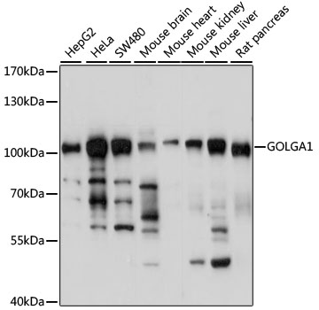 GOLGA1 / Golgin-97 Antibody - Western blot analysis of extracts of various cell lines, using GOLGA1 antibody at 1:1000 dilution. The secondary antibody used was an HRP Goat Anti-Rabbit IgG (H+L) at 1:10000 dilution. Lysates were loaded 25ug per lane and 3% nonfat dry milk in TBST was used for blocking. An ECL Kit was used for detection and the exposure time was 3s.