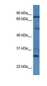 GOLGA1 / Golgin-97 Antibody - GOLGA1 / Golgin-97 antibody Western blot of HCT15 cell lysate. This image was taken for the unconjugated form of this product. Other forms have not been tested.