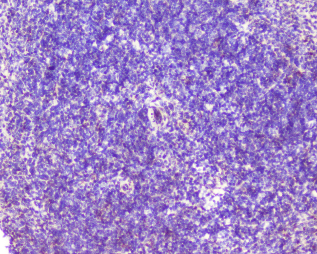 GOLGA2 / GM130 Antibody - IHC analysis of GM130 using anti-GM130 antibody. GM130 was detected in paraffin-embedded section of rat spleen tissue. Heat mediated antigen retrieval was performed in citrate buffer (pH6, epitope retrieval solution) for 20 mins. The tissue section was blocked with 10% goat serum. The tissue section was then incubated with 1µg/ml rabbit anti-GM130 Antibody overnight at 4°C. Biotinylated goat anti-rabbit IgG was used as secondary antibody and incubated for 30 minutes at 37°C. The tissue section was developed using Strepavidin-Biotin-Complex (SABC) with DAB as the chromogen.