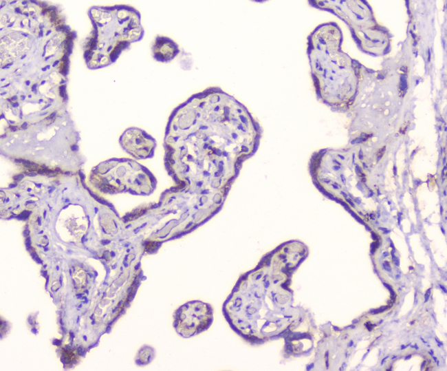 GOLGA2 / GM130 Antibody - IHC analysis of GM130 using anti-GM130 antibody. GM130 was detected in paraffin-embedded section of human placenta tissue. Heat mediated antigen retrieval was performed in citrate buffer (pH6, epitope retrieval solution) for 20 mins. The tissue section was blocked with 10% goat serum. The tissue section was then incubated with 1µg/ml rabbit anti-GM130 Antibody overnight at 4°C. Biotinylated goat anti-rabbit IgG was used as secondary antibody and incubated for 30 minutes at 37°C. The tissue section was developed using Strepavidin-Biotin-Complex (SABC) with DAB as the chromogen.