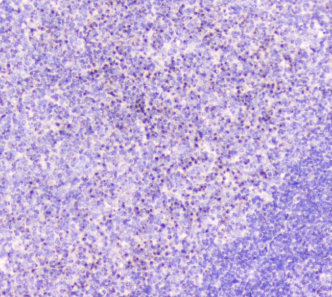 GOLGA2 / GM130 Antibody - IHC analysis of GM130 using anti-GM130 antibody. GM130 was detected in paraffin-embedded section of human tonsil tissue. Heat mediated antigen retrieval was performed in citrate buffer (pH6, epitope retrieval solution) for 20 mins. The tissue section was blocked with 10% goat serum. The tissue section was then incubated with 1µg/ml rabbit anti-GM130 Antibody overnight at 4°C. Biotinylated goat anti-rabbit IgG was used as secondary antibody and incubated for 30 minutes at 37°C. The tissue section was developed using Strepavidin-Biotin-Complex (SABC) with DAB as the chromogen.