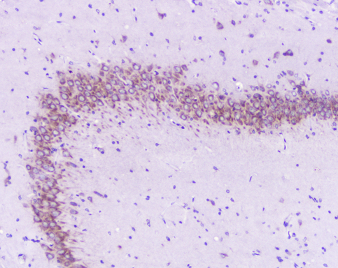 GOLGA2 / GM130 Antibody - IHC analysis of GM130 using anti-GM130 antibody. GM130 was detected in paraffin-embedded section of rat brain tissue. Heat mediated antigen retrieval was performed in citrate buffer (pH6, epitope retrieval solution) for 20 mins. The tissue section was blocked with 10% goat serum. The tissue section was then incubated with 1µg/ml rabbit anti-GM130 Antibody overnight at 4°C. Biotinylated goat anti-rabbit IgG was used as secondary antibody and incubated for 30 minutes at 37°C. The tissue section was developed using Strepavidin-Biotin-Complex (SABC) with DAB as the chromogen.