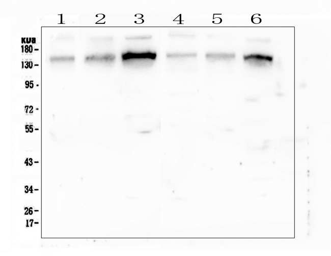GOLGA2 / GM130 Antibody - Western blot analysis of GM130 using anti-GM130 antibody. Electrophoresis was performed on a 5-20% SDS-PAGE gel at 70V (Stacking gel) / 90V (Resolving gel) for 2-3 hours. The sample well of each lane was loaded with 50ug of sample under reducing conditions. Lane 1: human placenta tissue lysates,Lane 2: human A549 whole cell lysate,Lane 3: human K562 whole cell lysate,Lane 4: human HL-60 whole cell lysate,Lane 5: human MCF-7 whole cell lysate,Lane 6: human Caco-2 whole cell lysate. After Electrophoresis, proteins were transferred to a Nitrocellulose membrane at 150mA for 50-90 minutes. Blocked the membrane with 5% Non-fat Milk/ TBS for 1.5 hour at RT. The membrane was incubated with rabbit anti-GM130 antigen affinity purified polyclonal antibody at 0.5 µg/mL overnight at 4°C, then washed with TBS-0.1% Tween 3 times with 5 minutes each and probed with a goat anti-rabbit IgG-HRP secondary antibody at a dilution of 1:10000 for 1.5 hour at RT. The signal is developed using an Enhanced Chemiluminescent detection (ECL) kit with Tanon 5200 system. A specific band was detected for GM130 at approximately 150KD. The expected band size for GM130 is at 113KD.