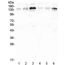 GOLGA2 / GM130 Antibody - Western blot testing of human 1) placenta, 2) A549, 3) K562, 4) HL-60, 5) MCF-7 and 6) Caco-2 cell lysate with GM130 antibody at 0.5ug/ml. Predicted molecular weight ~130 kDa.