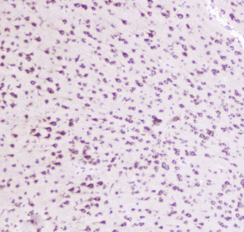 GOLGA2 / GM130 Antibody - IHC staining of FFPE mouse brain with GM130 antibody at 0.5ug/ml. HIER: boil tissue sections in pH6, 10mM citrate buffer, for 10-20 min followed by cooling at RT for 20 min.