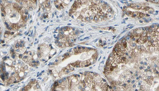 GOLGA2 / GM130 Antibody - 1:100 staining human prostate tissue by IHC-P. The sample was formaldehyde fixed and a heat mediated antigen retrieval step in citrate buffer was performed. The sample was then blocked and incubated with the antibody for 1.5 hours at 22°C. An HRP conjugated goat anti-rabbit antibody was used as the secondary.