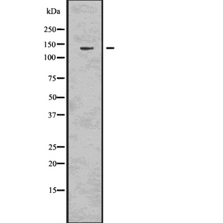 GOLGA2 / GM130 Antibody - Western blot analysis GM130 using Jurkat whole cells lysates