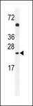 GOLGA2P5 Antibody - GOLGA2L1 Antibody (C-term) western blot analysis in A549 cell line lysates (35ug/lane).This demonstrates the GOLGA2L1 antibody detected the GOLGA2L1 protein (arrow).