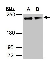 GOLGA3 Antibody - Sample (30 ug of whole cell lysate). A: A431, B: H1299. 5% SDS PAGE. GOLGA3 antibody diluted at 1:1000