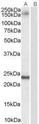 GOLGA3 Antibody - Antibody (0.1 ug/ml) staining of Hela lysate (35 ug protein in RIPA buffer). Primary incubation was 1 hour. Detected by chemiluminescence.