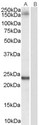 GOLGA3 Antibody - Antibody (0.1 ug/ml) staining of Hela lysate (35 ug protein in RIPA buffer). Primary incubation was 1 hour. Detected by chemiluminescence.