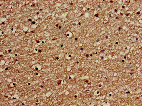 GOLGA3 Antibody - Immunohistochemistry of paraffin-embedded human brain tissue using GOLGA3 Antibody at dilution of 1:100