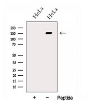 GOLGA3 Antibody - Western blot analysis of extracts of HeLa cells using GOLGA3 antibody. The lane on the left was treated with blocking peptide.