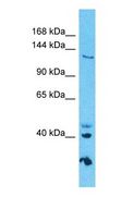 GOLGA3 Antibody - Western blot of GOLGA3 Antibody with human HepG2 Whole Cell lysate.  This image was taken for the unconjugated form of this product. Other forms have not been tested.
