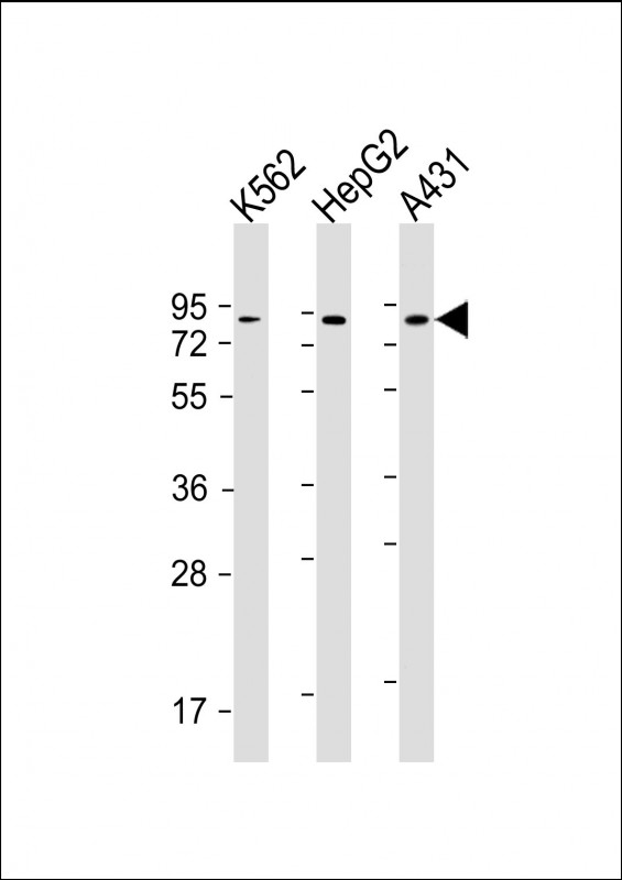 GOLGA5 Antibody - All lanes: Anti-GOLGA5 Antibody at 1:2000 dilution Lane 1: K562 whole cell lysate Lane 2: HepG2 whole cell lysate Lane 3: A431 whole cell lysate Lysates/proteins at 20 µg per lane. Secondary Goat Anti-mouse IgG, (H+L), Peroxidase conjugated at 1/10000 dilution. Predicted band size: 83 kDa Blocking/Dilution buffer: 5% NFDM/TBST.