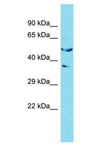 GOLGA6L2 Antibody - GOLGA6L2 antibody Western Blot of 293T. Antibody dilution: 1 ug/ml.  This image was taken for the unconjugated form of this product. Other forms have not been tested.