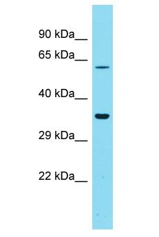 GOLGA6L4 Antibody - GOLGA6L4 antibody Western Blot of PANC1. Antibody dilution: 1 ug/ml.  This image was taken for the unconjugated form of this product. Other forms have not been tested.