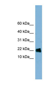 GOLGA7 Antibody - GOLGA7 antibody Western blot of HT1080 cell lysate. This image was taken for the unconjugated form of this product. Other forms have not been tested.