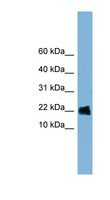 GOLGA7 Antibody - GOLGA7 antibody Western blot of HT1080 cell lysate. This image was taken for the unconjugated form of this product. Other forms have not been tested.