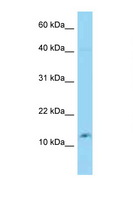 GOLGA7B Antibody - GOLGA7B / C10orf132 antibody Western blot of 3 Cell lysate. Antibody concentration 1 ug/ml.  This image was taken for the unconjugated form of this product. Other forms have not been tested.