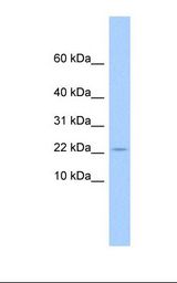 GOLGA7B Antibody - 721_B cell lysate. Antibody concentration: 1.0 ug/ml. Gel concentration: 10-20%.  This image was taken for the unconjugated form of this product. Other forms have not been tested.