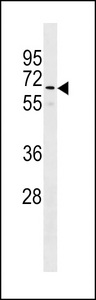 GOLGA8B / Golgin-67 Antibody - GOLGA8B Antibody western blot of CEM cell line lysates (35 ug/lane). The GOLGA8B antibody detected the GOLGA8B protein (arrow).
