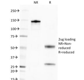 Golgi Body Antibody - SDS-PAGE Analysis of Purified, BSA-Free Golgi Complex Antibody (clone 371-4). Confirmation of Integrity and Purity of the Antibody.