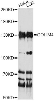 GOLIM4 / GPP130 Antibody - Western blot analysis of extracts of various cell lines, using GOLIM4 antibody at 1:1000 dilution. The secondary antibody used was an HRP Goat Anti-Rabbit IgG (H+L) at 1:10000 dilution. Lysates were loaded 25ug per lane and 3% nonfat dry milk in TBST was used for blocking. An ECL Kit was used for detection and the exposure time was 30s.