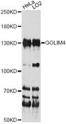 GOLIM4 / GPP130 Antibody - Western blot analysis of extracts of various cell lines, using GOLIM4 antibody at 1:1000 dilution. The secondary antibody used was an HRP Goat Anti-Rabbit IgG (H+L) at 1:10000 dilution. Lysates were loaded 25ug per lane and 3% nonfat dry milk in TBST was used for blocking. An ECL Kit was used for detection and the exposure time was 30s.