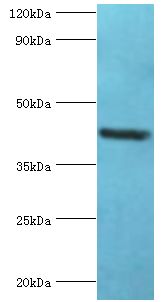 GOLM1 / GP73 / GOLPH2 Antibody - Western blot. All lanes: Golgi membrane protein 1 antibody at 7 ug/ml+HeLa whole cell lysate. Secondary antibody: Goat polyclonal to rabbit at 1:10000 dilution. Predicted band size: 45 kDa. Observed band size: 45 kDa.