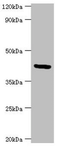 GOLM1 / GP73 / GOLPH2 Antibody - Western blot All lanes: Golgi membrane protein 1 antibody at 7µg/ml + Hela whole cell lysate Secondary Goat polyclonal to rabbit IgG at 1/10000 dilution Predicted band size: 46, 45 kDa Observed band size: 46 kDa