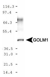 GOLM1 / GP73 / GOLPH2 Antibody - GOLPH2 Antibody - WB detection of GOLM1 in HeLa whole cell extract.