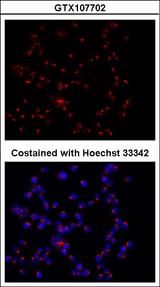 GOLM1 / GP73 / GOLPH2 Antibody - Immunofluorescence of 70%methanol,30% Acetone-fixed HCT116 using GOLPH2 antibody at 1:200 dilution.
