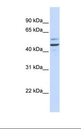 GOLM1 / GP73 / GOLPH2 Antibody - Fetal brain lysate. Antibody concentration: 1.0 ug/ml. Gel concentration: 12%.  This image was taken for the unconjugated form of this product. Other forms have not been tested.