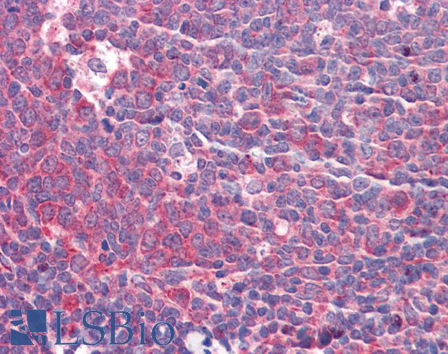 GOLM1 / GP73 / GOLPH2 Antibody - Anti-GOLM1 / GOLPH2 antibody IHC of human tonsil. Immunohistochemistry of formalin-fixed, paraffin-embedded tissue after heat-induced antigen retrieval. Antibody concentration 5 ug/ml.  This image was taken for the unconjugated form of this product. Other forms have not been tested.