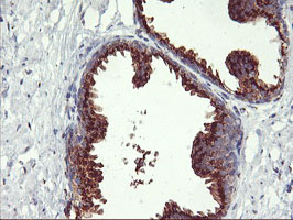 GOLM1 / GP73 / GOLPH2 Antibody - IHC of paraffin-embedded Human prostate tissue using anti-GOLM1 mouse monoclonal antibody.