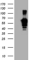 GOLM1 / GP73 / GOLPH2 Antibody - HEK293T cells were transfected with the pCMV6-ENTRY control (Left lane) or pCMV6-ENTRY GOLM1 (Right lane) cDNA for 48 hrs and lysed. Equivalent amounts of cell lysates (5 ug per lane) were separated by SDS-PAGE and immunoblotted with anti-GOLM1.