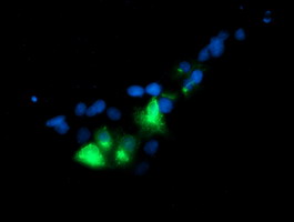 GOLM1 / GP73 / GOLPH2 Antibody - Anti-GOLM1 mouse monoclonal antibody immunofluorescent staining of COS7 cells transiently transfected by pCMV6-ENTRY GOLM1.