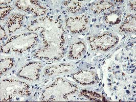 GOLM1 / GP73 / GOLPH2 Antibody - IHC of paraffin-embedded Human Kidney tissue using anti-GOLM1 mouse monoclonal antibody.