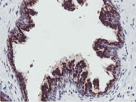 GOLM1 / GP73 / GOLPH2 Antibody - IHC of paraffin-embedded Human prostate tissue using anti-GOLM1 mouse monoclonal antibody.