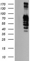 GOLM1 / GP73 / GOLPH2 Antibody - HEK293T cells were transfected with the pCMV6-ENTRY control (Left lane) or pCMV6-ENTRY GOLM1 (Right lane) cDNA for 48 hrs and lysed. Equivalent amounts of cell lysates (5 ug per lane) were separated by SDS-PAGE and immunoblotted with anti-GOLM1.