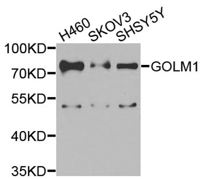 GOLM1 / GP73 / GOLPH2 Antibody - Western blot analysis of extracts of various cells.