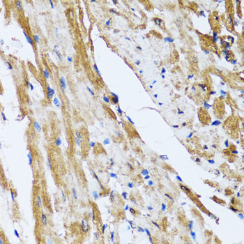 GOLM1 / GP73 / GOLPH2 Antibody - Immunohistochemistry of paraffin-embedded rat heart tissue.