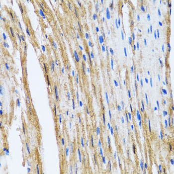 GOLM1 / GP73 / GOLPH2 Antibody - Immunohistochemistry of paraffin-embedded mouse heart tissue.